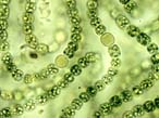 Cyanobacteria (Blue Green Algae) Microscopic View