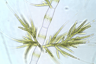 Algae under a microscope