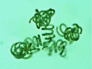 photograph of Cyanobacteria Dolichospermum sp., Clear Lake 2017
