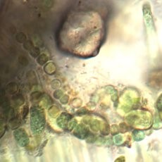 image of soft-bodied algae specimens magnified by a microscope
