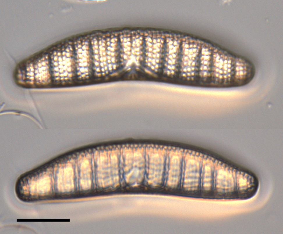 image of two diatom specimens magnified by a microscope, species Epithemia adnate